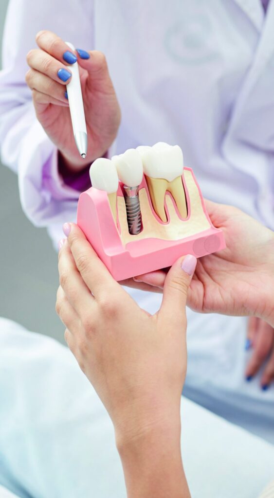 Dentist showing a dental implant model to a patient