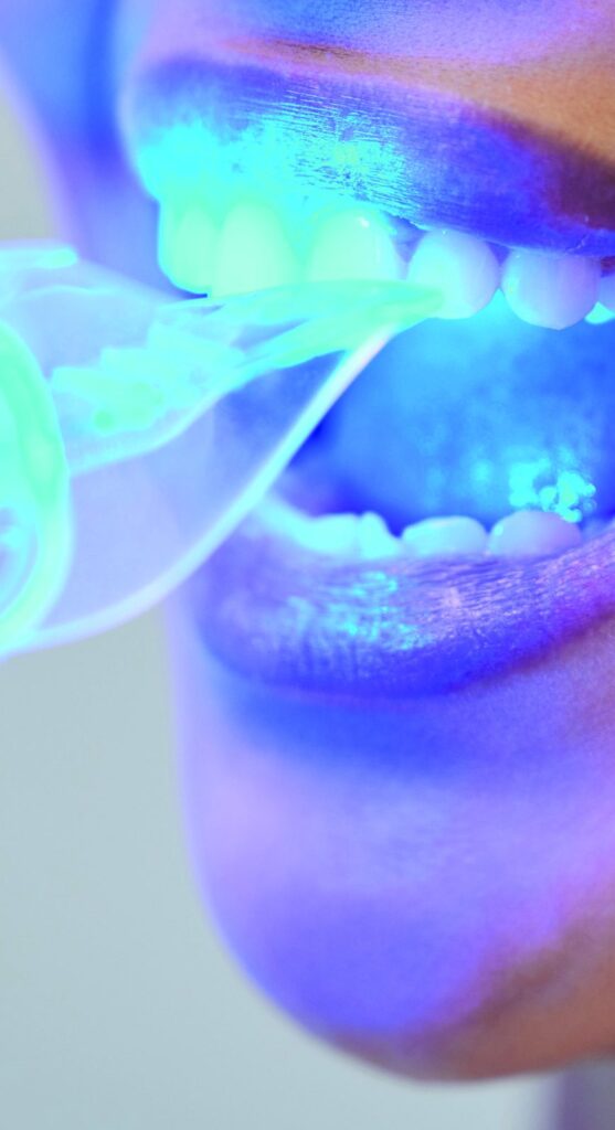 Professional teeth whitening with blue light