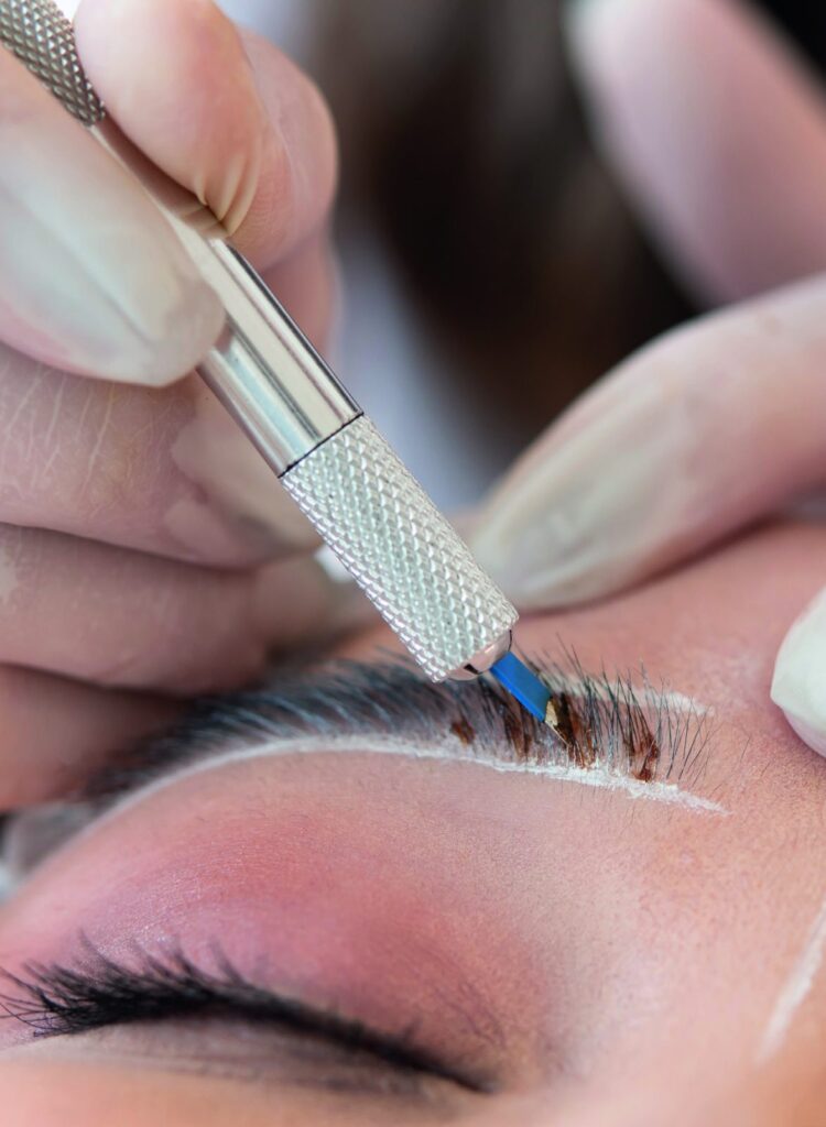Eyebrow transplant procedure