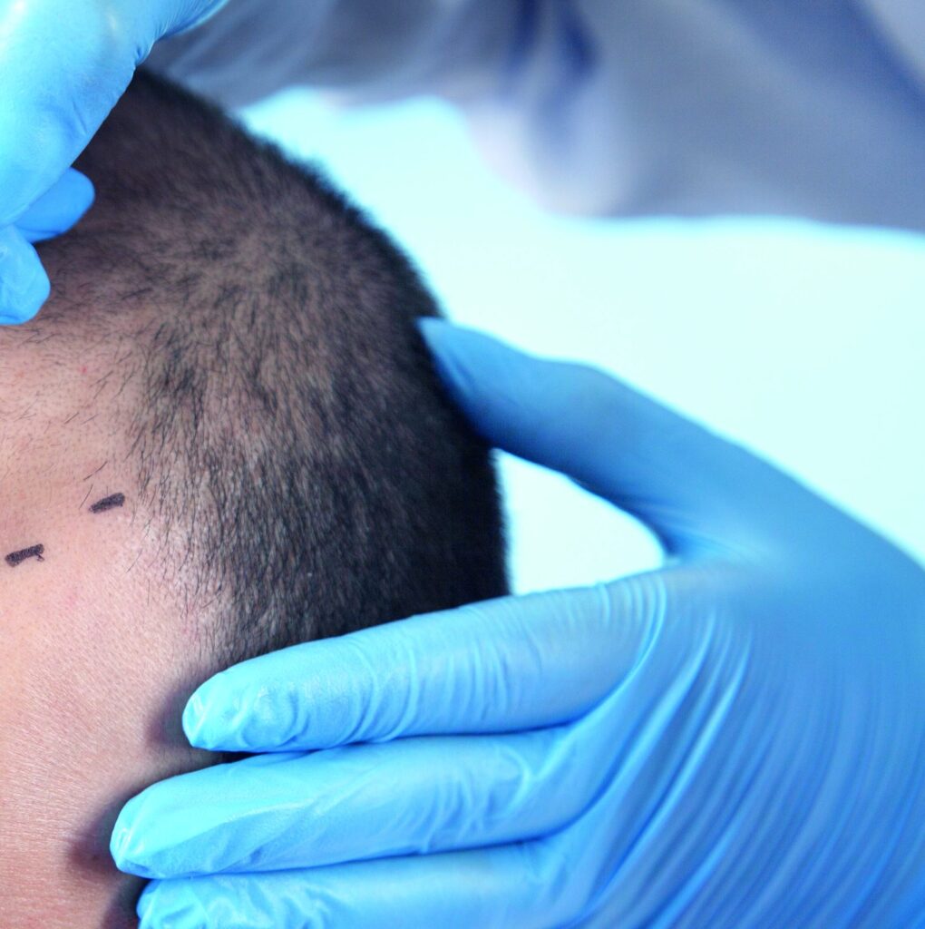 Doctor examining a patient's scalp