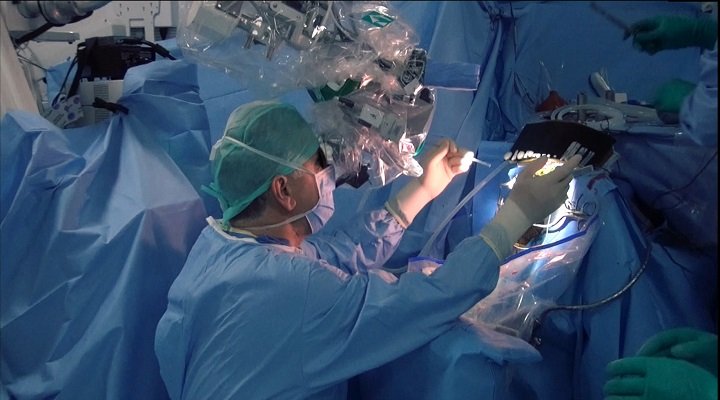 Neurosurgeon operating with a surgical microscope