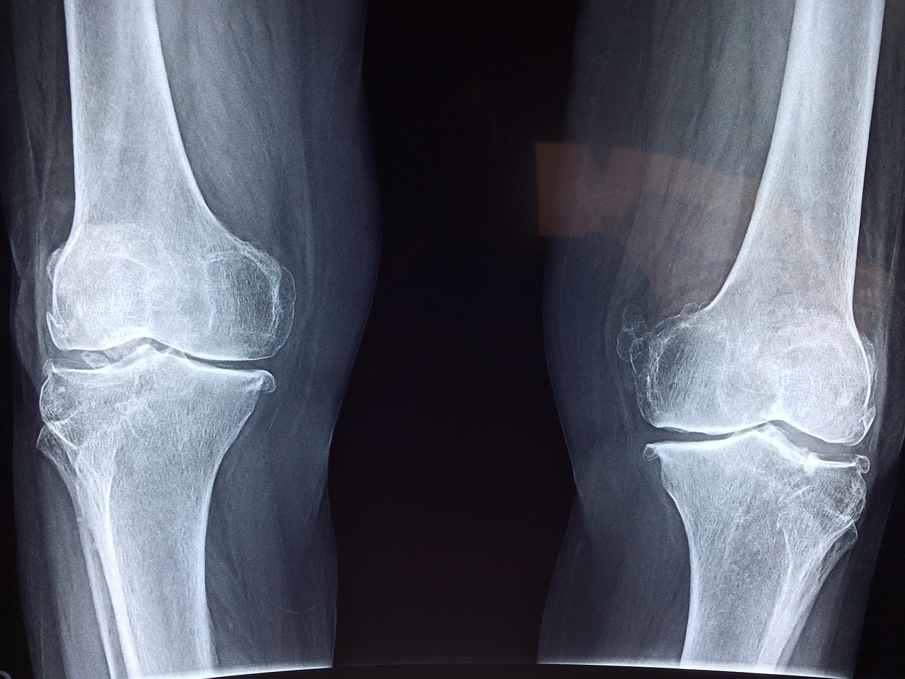 Illustration of joints and spine on a running figure