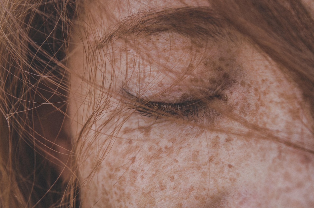 Hirsutism Clinic - specialist hospital care